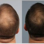 کوکتل مزولایک هیرمن Hairman حجم 10 میل