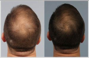 کوکتل مزولایک هیرمن Hairman حجم 10 میل