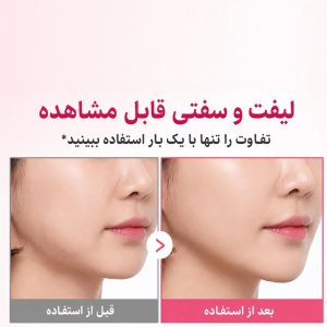 کرم ضد چروک گردن کلاژن PDRN گواشا مدی کیوب