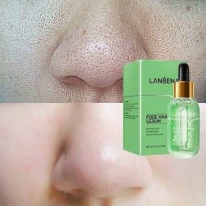 چسب بینی منافذ باز لانبنا شماره 2
